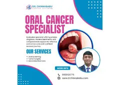 Oral Cancer Specialist in Hyderabad | Dr Chinnababu Sunkavalli