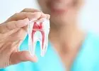 Best Clinic For Root Canal Treatment in Emerald Hill