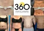 360 Plastic Surgery